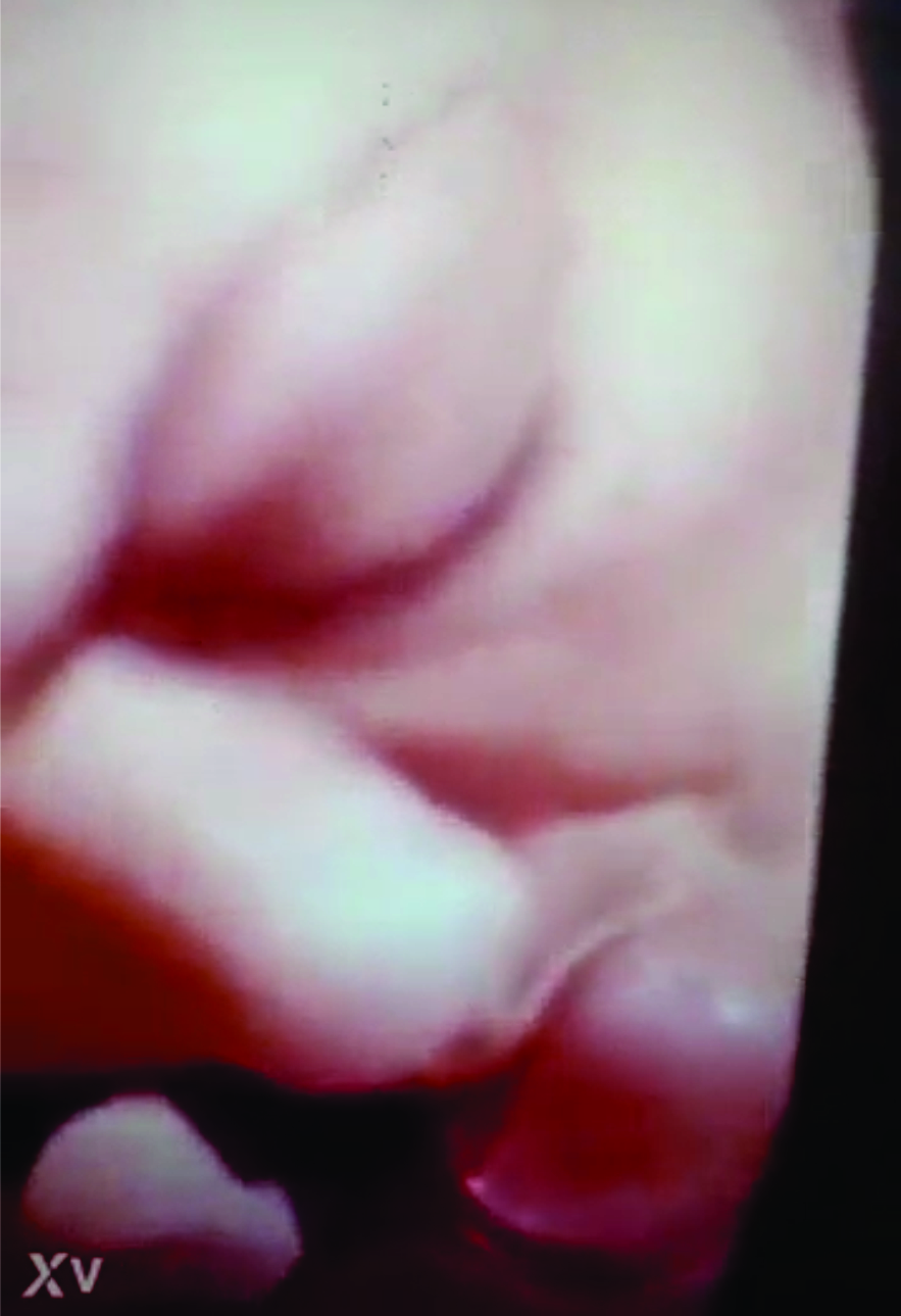 rubia  chupando pija como loca